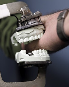 In this April 17, 2013 photo, Peter Bush, Research Scientist at the University at Buffalo,  demonstrates a modified Vise-Grip tool attached to a dental mold that is used for test bites in skin, at the school in Buffalo, N.Y. Bite marks, long accepted as criminal evidence, now face doubts about reliability.  (AP Photo/David Duprey)