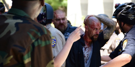 Police escort wounded man away from in front of the Cpitol in Scramento, Sunday, June 26, 2016, after members of right-wing extremists groups holding a rally outside the California state Capitol building clashed with counter-protesters, authorities said. Sacramento Police spokesman Matt McPhail said the Traditionalist Workers Party had scheduled and received a permit to protest at noon Sunday in front of the Capitol. McPhail said a group showed up to demonstrate against them. (AP Photo/Steven Styles)