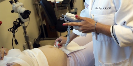 Nurse practitioner Juliana Duque uses a fetal heart monitor on a patient who is in her first trimester of pregnancy at the Borinquen Medical Center, Tuesday, Aug. 2, 2016 in Miami. The CDC has advised pregnant women to avoid travel to the nearby neighborhood of Wynwood where mosquitoes are apparently transmitting Zika directly to humans. The patient also had a test for Zika following her exam. (AP Photo/Lynne Sladky)