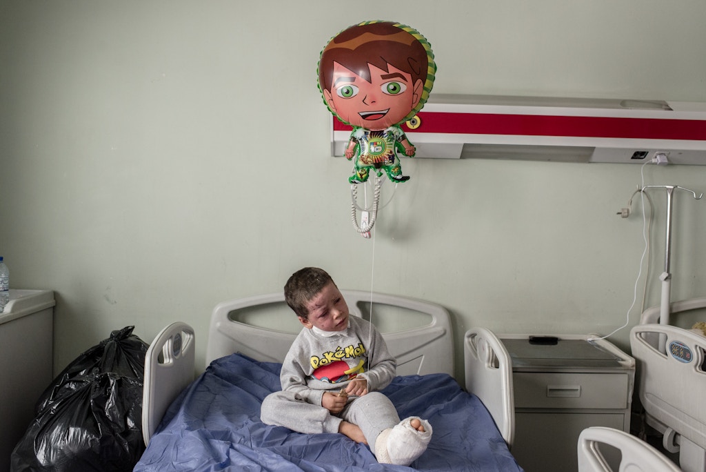 Awra Ali, 4, on her hospital bed at West Erbil Emergency in Erbil, Iraq on April 10, 2017. (posed)