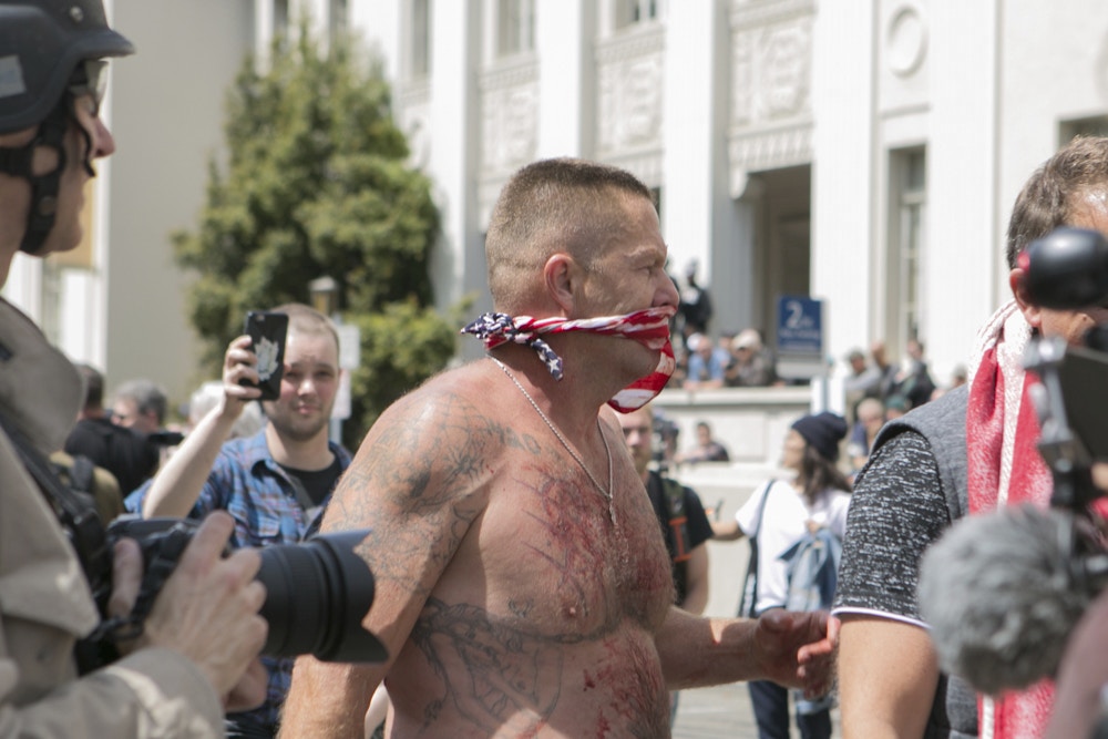 An injured Trump supporter covers his bleeding mouth during a free speech rally at Martin Luther King Jr. Civic Center Park in Berkeley, California, United States of America on April 15, 2017. (Photo by Emily Molli/NurPhoto) *** Please Use Credit from Credit Field ***(Sipa via AP Images)