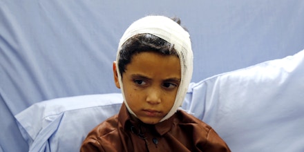 SANA'A, YEMEN - AUGUST 12:  A Yemeni child receives medical treatment after he was injured by an airstrike hitting a bus he was riding on earlier this week, on August  12, 2018 at a hospital in Saada, Yemen. (Photo by Mohammed Hamoud/Getty Images)