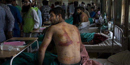 FILE - In this Aug. 18, 2016 file photo, Sameer Ahmed, a Kashmiri man allegedly beaten up by Indian soldiers at Khrew village, recovers at a local hospital in Srinagar, Indian controlled Kashmir. A prominent rights group in Indian-controlled Kashmir is advocating United Nations to establish a commission of inquiry to probe endemic use of torture by government forces who have faced decades long anti-India uprising in the disputed region. (AP Photo/Dar Yasin, File)