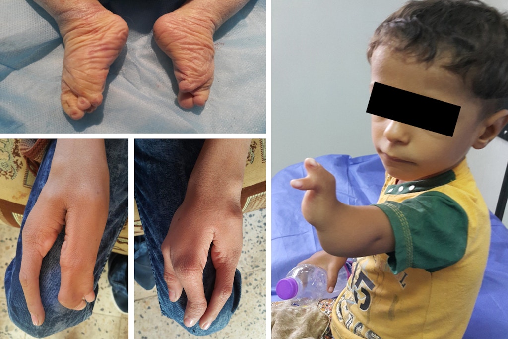 Children Born With Deformities Near U.S. Base in Iraq