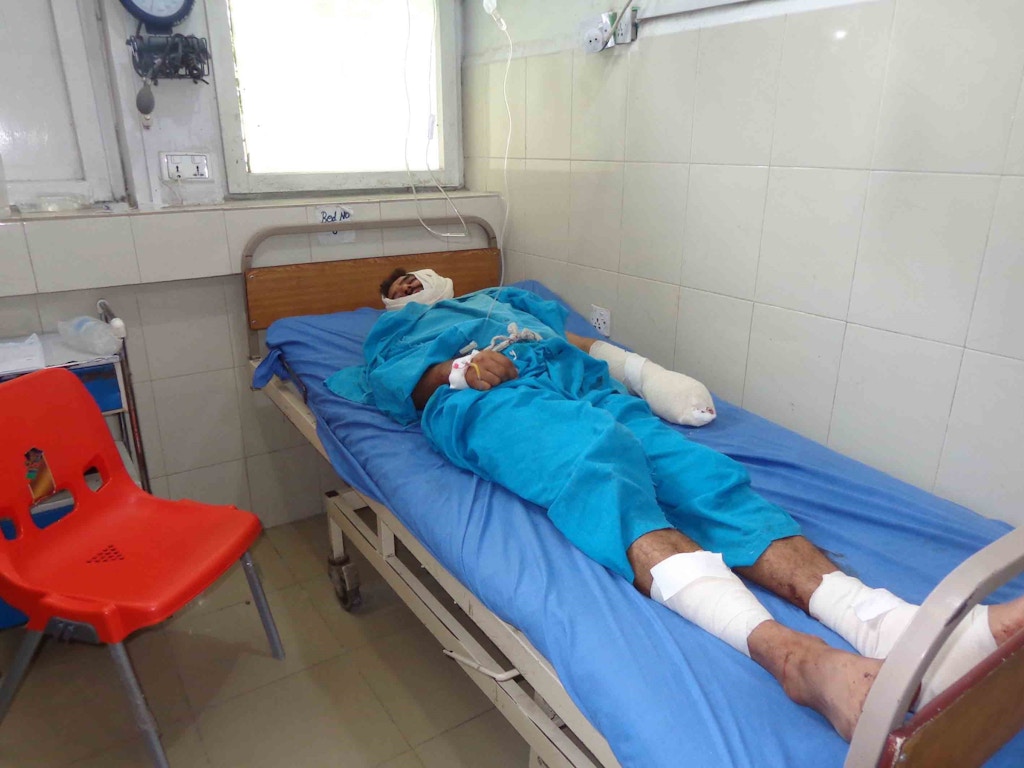 A wounded man lies on a stretcher at Jalalabad hospital after a suspected US drone strike killing at least 16 people in Nangarhar, Afghanistan on September 28, 2016.