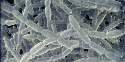 Illustration of Legionella pneumophila bacteria, the cause of Legionnaires' disease. These bacilli (rod-shaped bacteria) are Gram-negative. L. pneumophila was identified as a pathogen (agent of disease) after a mysterious outbreak of pneumonia caused 29 deaths at an American Legion convention in 1976. This bacterium was found living in water tanks, showerheads and air-conditioning systems. The disease causes fatal pneumonic lung damage in the elderly and unfit. (Photo by: SCIENCE PHOTO LIBRARY via AP Images)