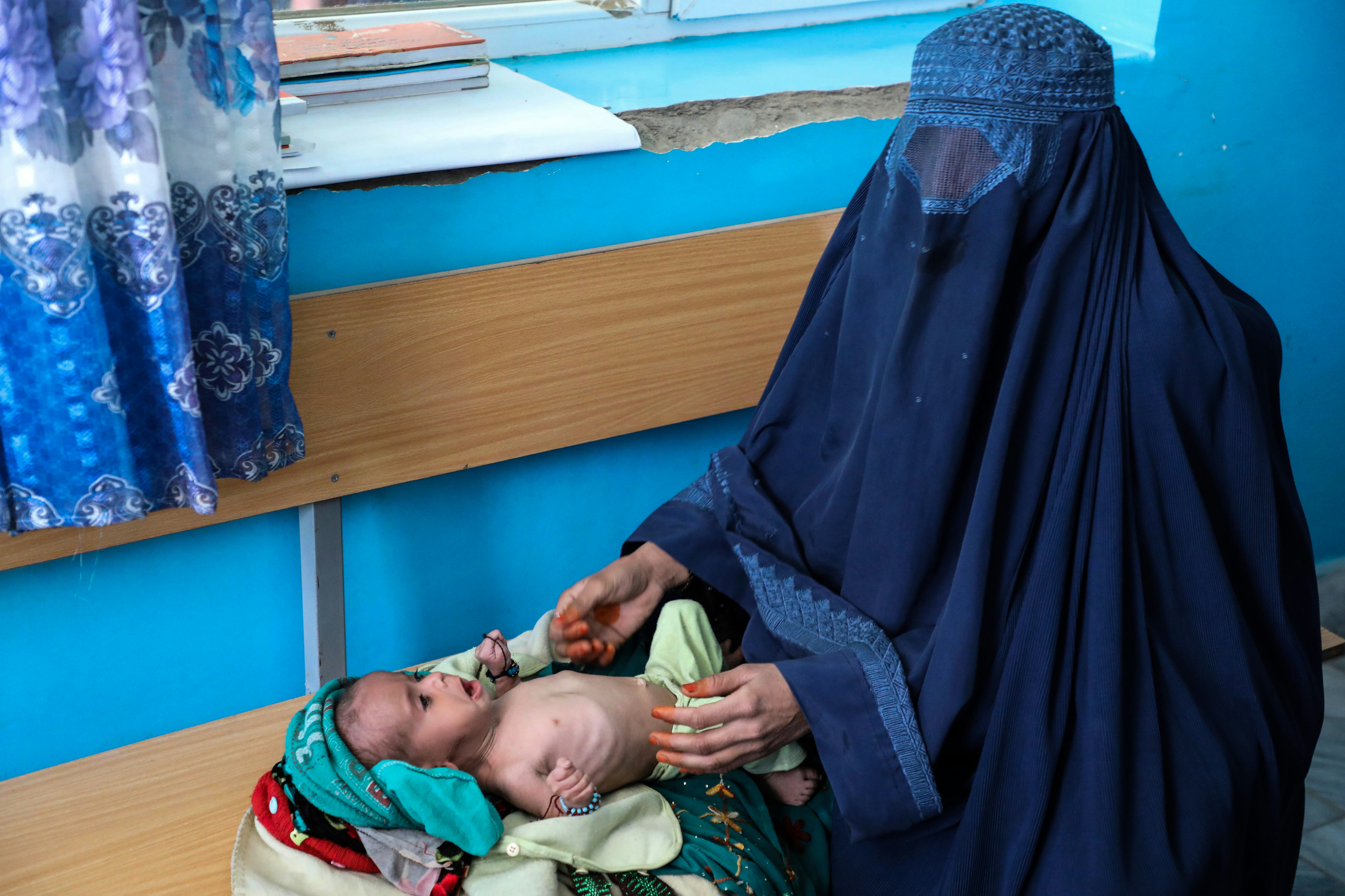 КАБУЛ, АФГАНИСТАН - 16 ЯНВАРЯ: Афганские дети, страдающие от недоедания, в больнице в Кабуле, Афганистан, 16 января 2022 года. В Афганистане дети не могут стоять на ногах, несмотря на свой возраст;  причина просто голод.  Уровень недоедания в стране стремительно растет.  Дети, страдающие гипотрофией, которая определяется как постоянная нехватка питательных элементов, необходимых организму человека, лишены своего основного источника питания новорожденных — грудного молока.  Матерей, не имеющих даже доступа к жизненно важным основным продуктам питания, в короткие сроки отлучают от груди.  Отсутствие необходимых пищевых добавок вызывает видимое замедление развития у новорожденных и детей.  (Фото Сайеда Ходайберди Садата/Агентство Анадолу через Getty Images)