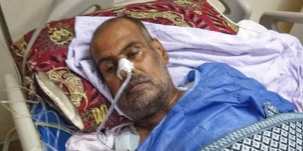 Adel Al Manthari, then a civil servant in the Yemeni government, is treated for severe burns, a fractured hip, and serious damage to the tendons, nerves, and blood vessels in his left hand following a drone strike in Yemen in 2018.